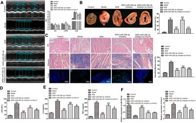 Corrigendum: Artemisinin relieves myocardial ischemia-reperfusion injury via modulating miR-29b-3p and hemicentin 1